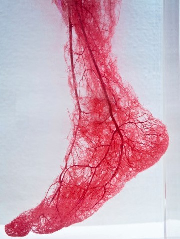 ضيق الأوعية الدموية الطرفية